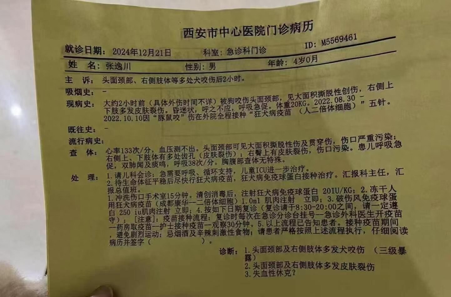 iu黑料：西安灞桥区豁口村恶犬伤人事件：4岁男童重伤抢救中，警方调查犬只来源-安稳项目网-网上创业赚钱首码项目发布推广平台-首码网